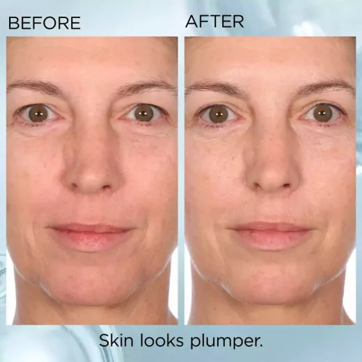 Elizabeth Arden Hyaluronic Acid Cilt Nemlendirici ve Dolgunlaştırıcı Kapsül Serum 30 Adet