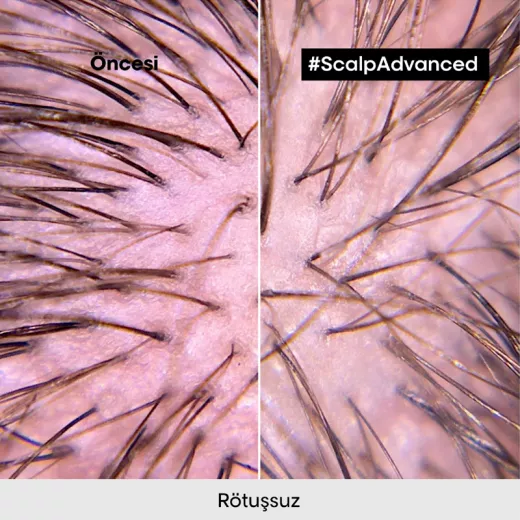 LOREAL Scalp Advanced Anti-Discomfort Hassas Baş Derisi İçin Yatıştırıcı Şampuan 500ml