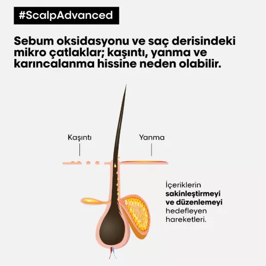 LOREAL Scalp Advanced Anti-Discomfort Hassas Baş Derisi İçin Yatıştırıcı Şampuan 500ml