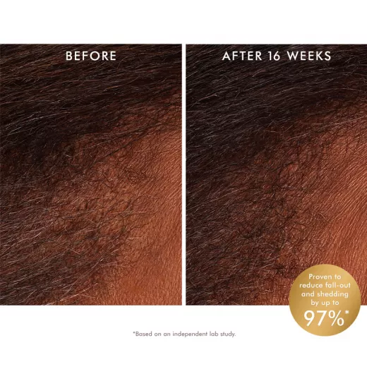Moroccanoil Scalp Saç ve Saç Derisi Bakım Toniği 250ml